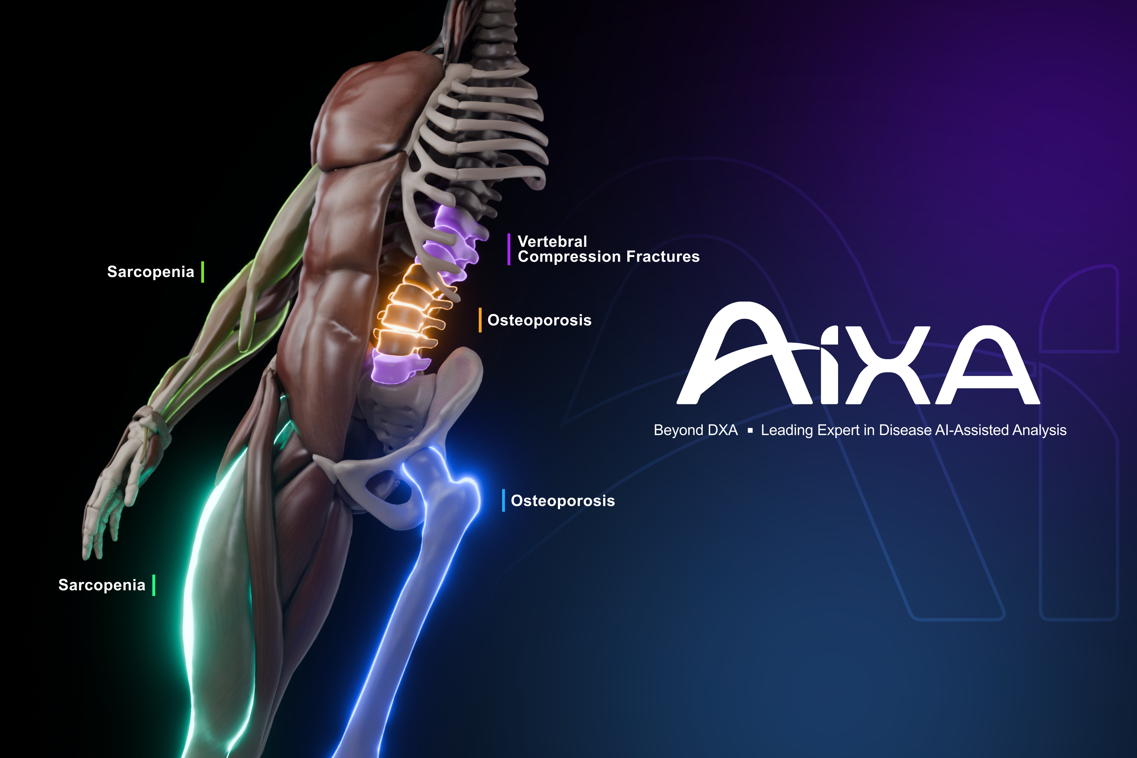 AIXA