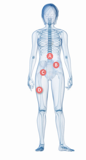 Body Diagram